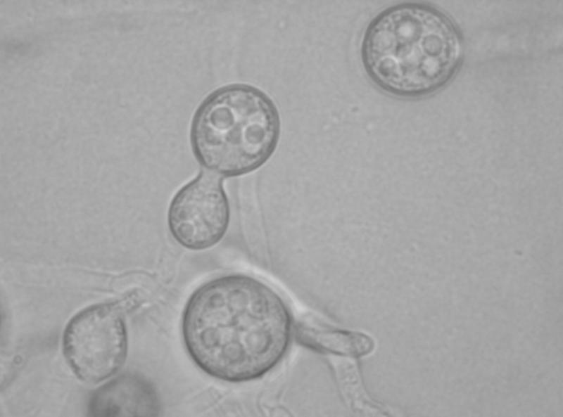 Light microscopic picture of Mrakia fibulata sp. nov. (DSM 103931)