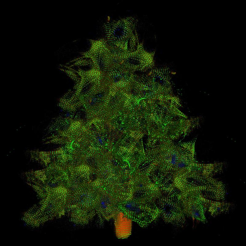 Muskelzellen in der Weihnachtszeit (Collage aus Einzelzellen, die Titin-GFP und titin-DsRed exprimieren).