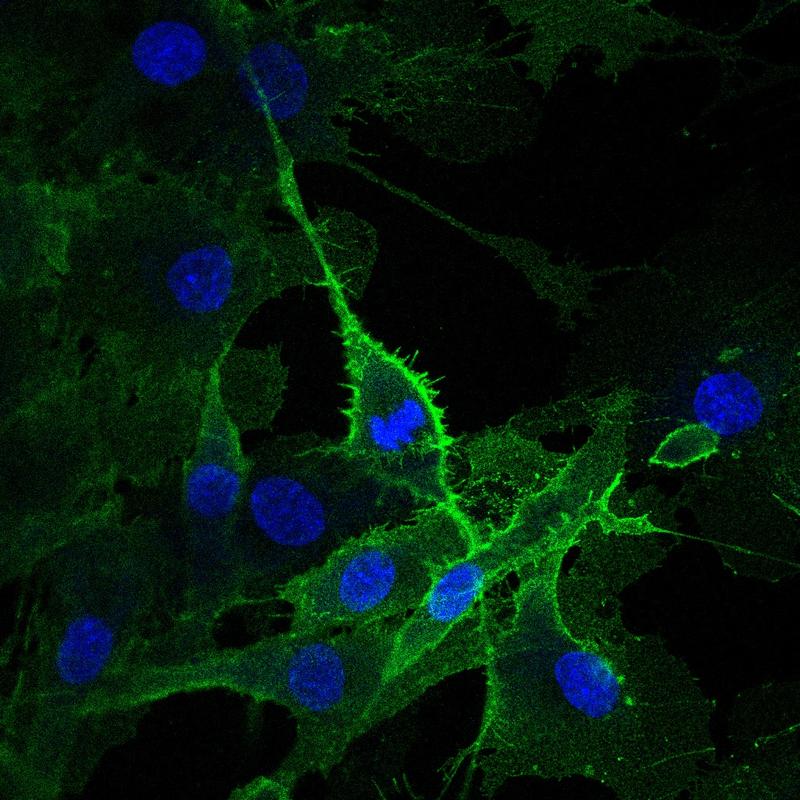 Lavins Muskelzellpopulation zeigt eine starke Expression des Oberflächenproteins CLEC14A (grün).