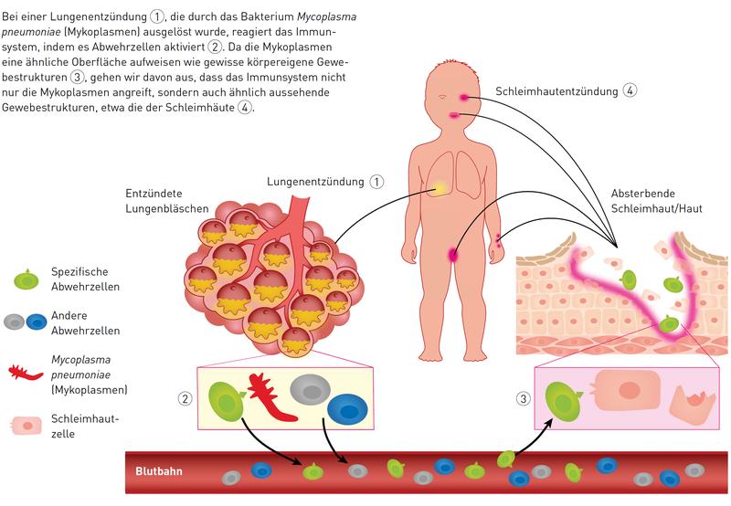 The reason why infections with M. pneumoniae often lead to skin and mucous membrane lesions.