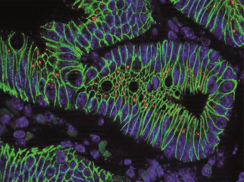 Entzündete Darmschleimhaut unter dem Mikroskop. In rot ist ein Signalmolekül angefärbt, welches bei einer Entzündung hochreguliert ist.