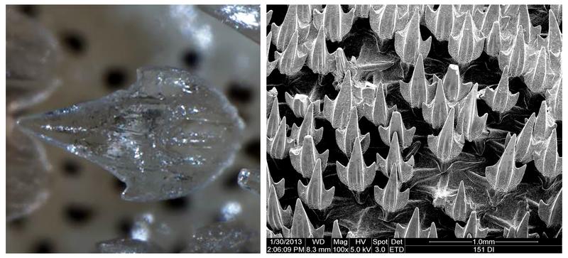 Dentikel – die modifizierten Schuppen – eines Puffotter-Katzenhais durch ein Lichtmikroskop (links) bzw. ein Rasterelektronenmikroskop (rechts) gesehen.