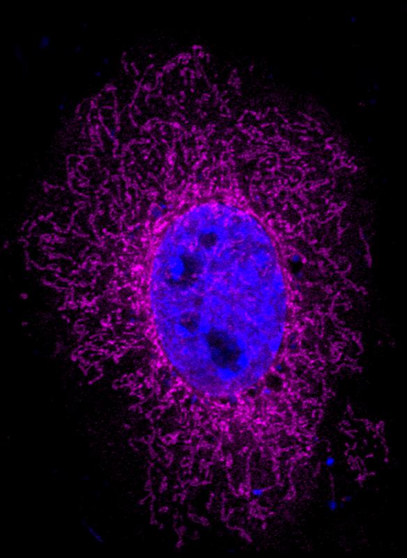 Das ARHGAP11B-Protein (Magenta) ist in den Mitochondrien vorhanden. Der Zellkern wird durch DAPI (blau) visualisiert. 