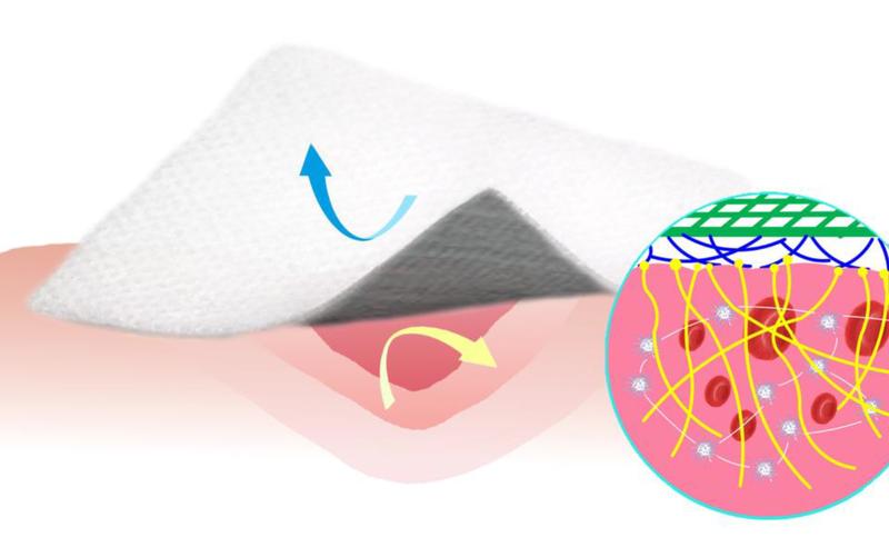 Fördert die Heilung und lässt sich später leicht wieder abziehen: Der neuartige Wundverband mit einer Beschichtung aus Silikon und Kohlenstoff-Nanofasern.