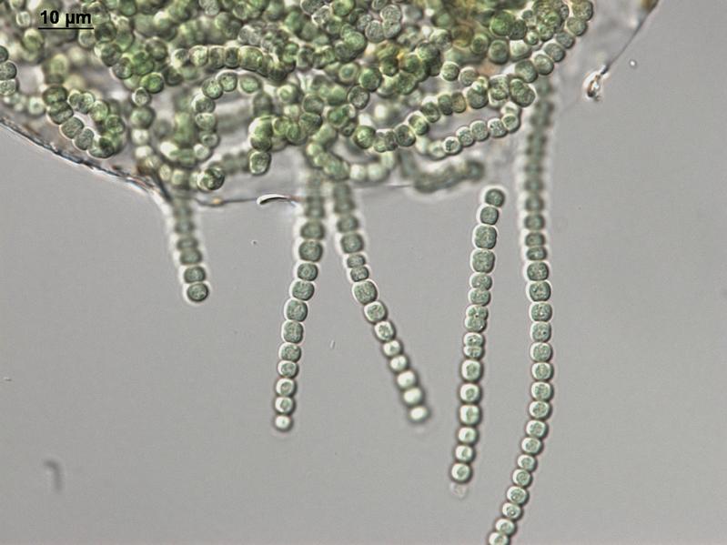 Mikroskopische Aufnahme der Cyanobakterienart Nostoc sp. Sie wurde aus der Grit Crust isoliert und wird nun in der Algensammlung in Pirmasens im Hinblick auf nützliche Stoffwechselprodukte untersucht
