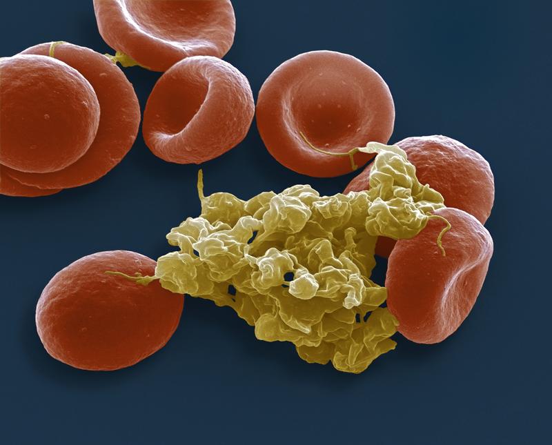 Erythrocytes and Platelets