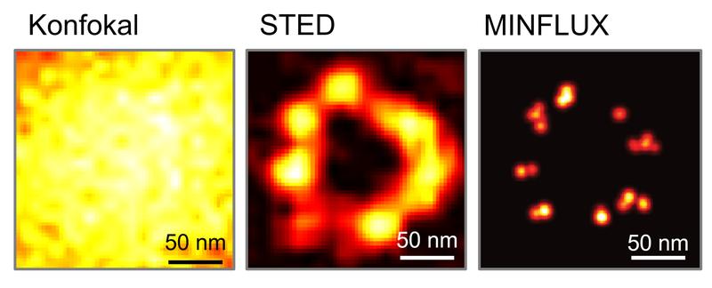 Der Vergleich dokumentiert die epochalen Auflösungs-Durchbrüche in der Fluoreszenzmikroskopie: Die STED-Mikroskopie erreichte bereits vor über zehn Jahren 