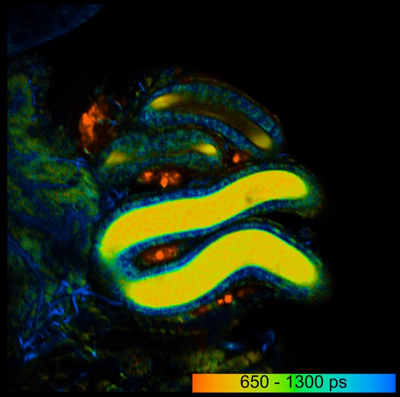 : Falschfarbenbild der Fluoreszenz-Lebenszeit des Stoffwechselmoleküls NADH eines Spermienhaufens (hier gelb) in einem weiblichen Spermienspeicherorgan in der Taufliege.