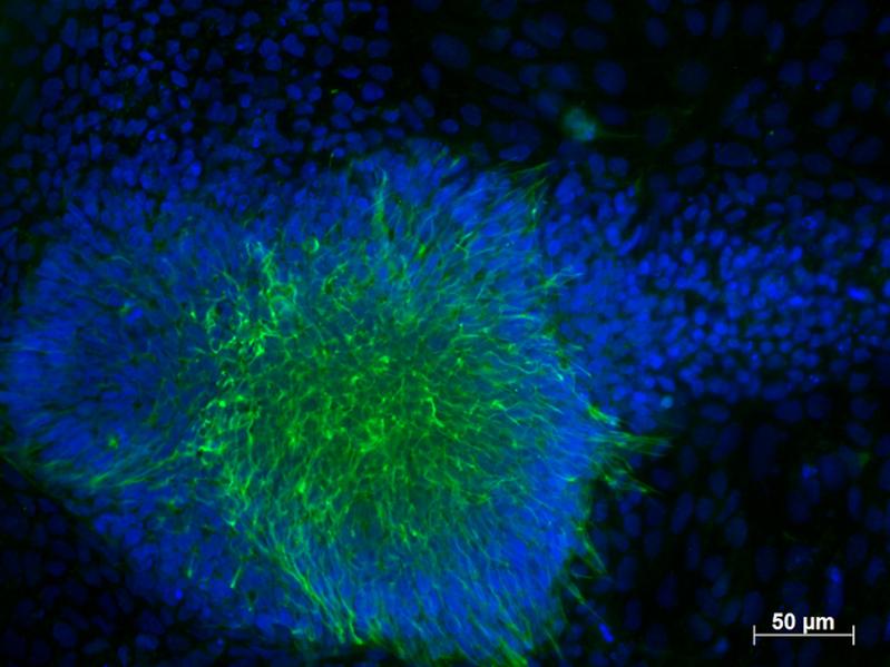 Fluoreszenzmikroskopische Aufnahme induzierter pluripotenter Stammzellen eines gesunden Blutspenders differenziert zu frühem Ektoderm.