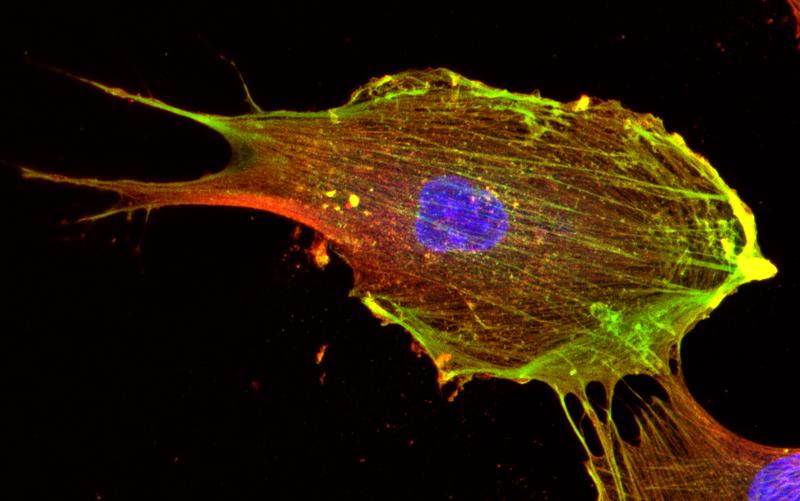 Die fluoreszenzmikroskopische Aufnahme eines Fibroblasten zeigt filamentöse Strukturen des Zytoskeletts, bestehend aus beta-Aktin (grün) und gamma-Aktin (rot). Die DNA im Zellkern erscheint blau.