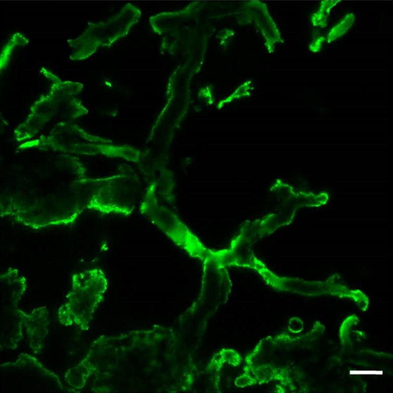 Fluoreszenzmarkierung des Chitins in einem versteinerten Myzel; Aufnahme mittels konfokaler Laser-Scanning-Mikroskopie, Maßstab 10 µm.