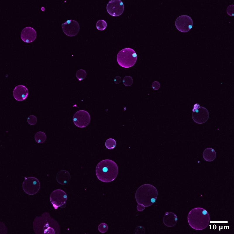 Synthetische Zellen mit Kompartimenten. Magenta kennzeichnet die Lipidmembran, Cyan die fluoreszenzmarkierten membranfreien Unterkompartimente. 