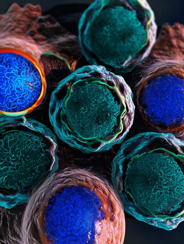 Leukemia cells are depicted in green, normal blood cells in red, and the intricate bundles in each cell visualize the complex arrangement of DNA and chromatin in the cell nucleus.