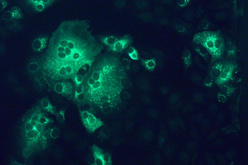 Affennierenzellen, die mit dem MERS-Coronavirus (grün) infiziert sind. Wie Charité-Forschende jetzt feststellten, lässt sich die Vermehrung des Virus mit SKP2-Hemmern deutlich reduzieren. 