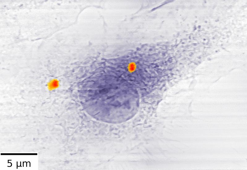 Zwei Ansammlungen von Antibiotika-beladenen Eisen-Nanocontainern (rot) in einer Makrophage. 