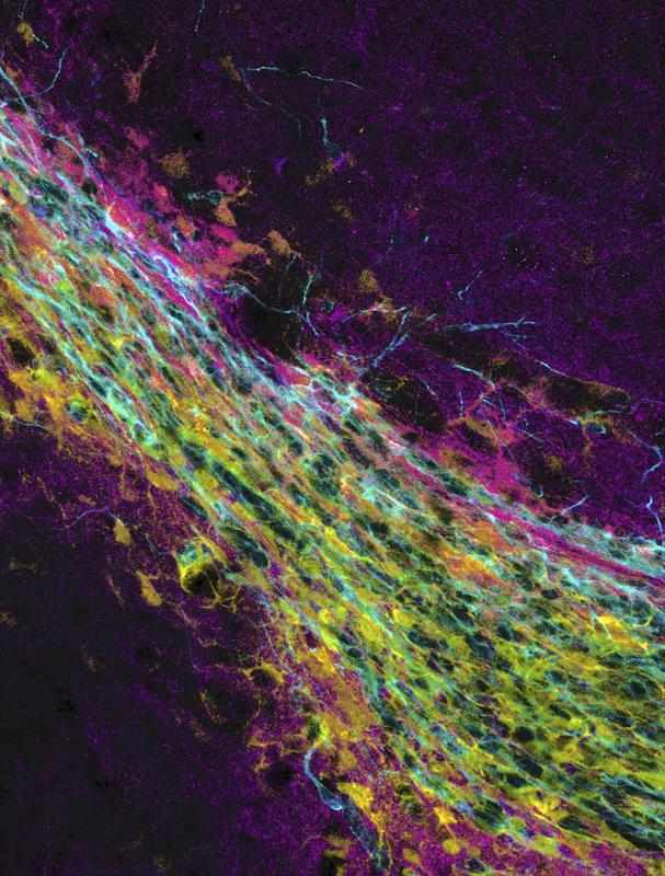 Neuronale Vorläuferzellen wandern aus der subependymalen Zone zum Riechkolben. 