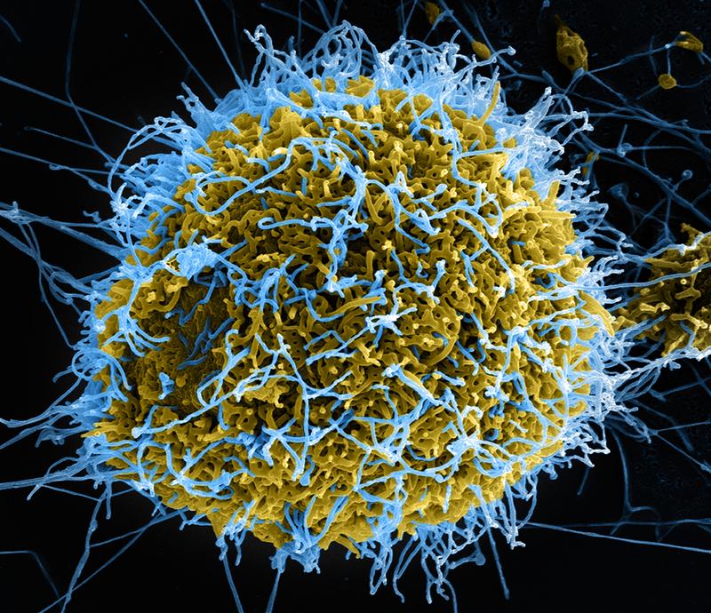 The digitally-colorized scanning electron microscopic (SEM) image depicts numerous filamentous Ebola virus particles (blue) budding from a chronically-infected cell.