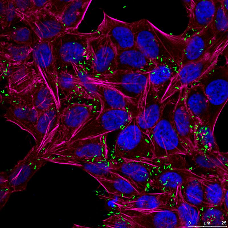 Fluoreszenz-Mikroskopiebild von Campylobacter jejuni (grün), die menschliche Zellen (HeLa) infiziert haben. Die Zellkerne der menschlichen Wirtszellen in blau und das Zellskelett (Aktin) in magenta.