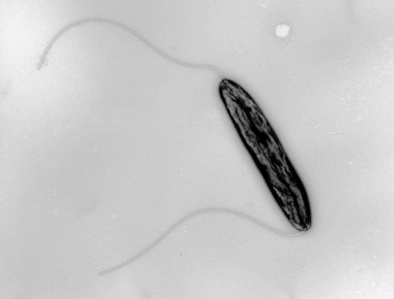Der Lebensmittelkeim Campylobacter jejuni trägt zwei fadenförmige Strukturen, die sogenannten Flagellen, mit denen es sich fortbewegen kann. 