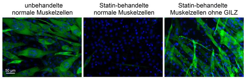 Left: Undamaged cell cultures with mature muscle fibres (green). Centre: Reduced muscle fibre formation after treatment with statins. Right: GILZ deactivated: No damage to statin-treated muscle cells