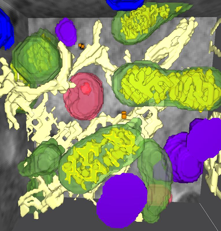 Kombination der einzelnen Aufnahmen zu einem 3D-Bild der Zellarchitektur mit Mitochondrien (grün), Lysosomen (lila), multivesikulären Körperchen (rot) und dem endoplasmatischen Retikulum (beige). 