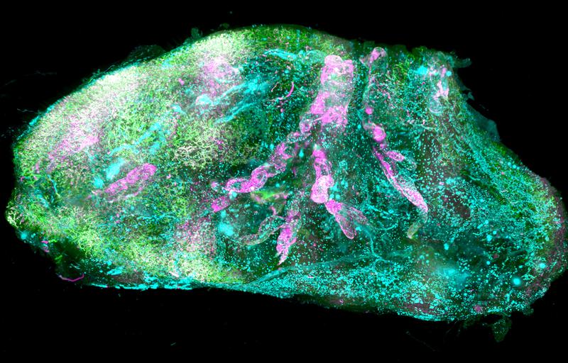 Vaskuläre und Glomeruli-Details der menschlichen Niere