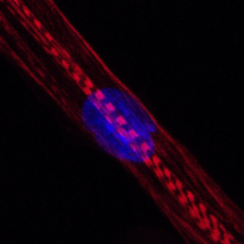 Humane Muskelzelle. Bei Menschen, die Statine nehmen, war unter anderem die Produktion von Myosinen gestört. Diese Proteine sind im Bild rot angefärbt, der Zellkern blau. 