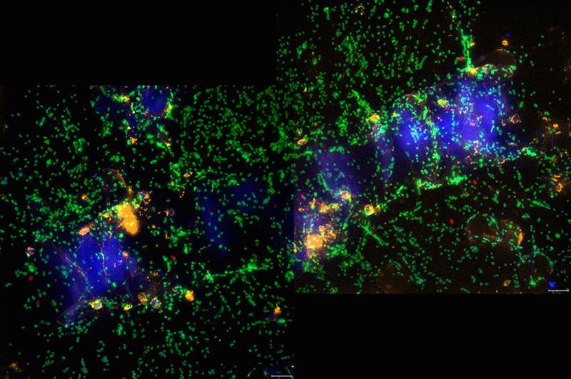 Algal cells (blue) surrounded by bacteria (green) devouring their sweet contents. 