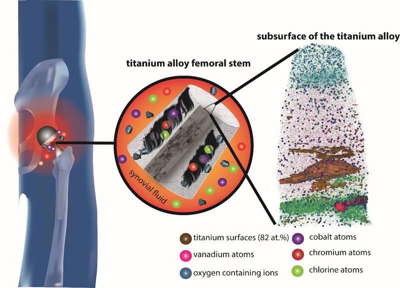 Atom Probe Tomography helps in understanding the metal ion release of hip implants