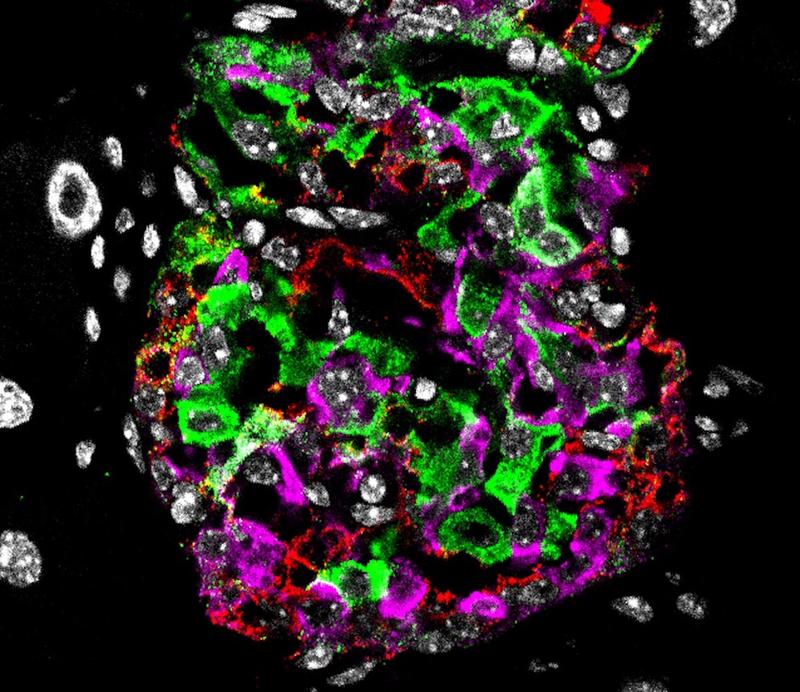 Langerhans´sche Inseln des Pankreas einer diabetischen Maus: Zellkerne in Weiß, Betazellen und Insulin in Grün, Alphazellen (Hormon Glucagon) in Rot und Deltazellen (Hormon Somatostatin) in Magenta. 