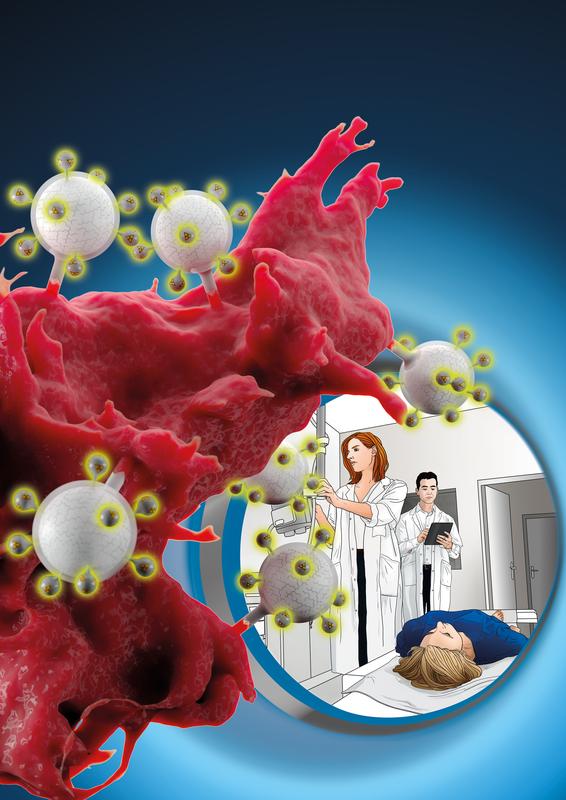 Ein Team um Forscher des HZDR hat bioverträgliche Nanopartikel mit einem Antikörperfragment ausgestattet, das gezielt an ein Protein bindet, das von bestimmten Krebszellen im Übermaß produziert wird.
