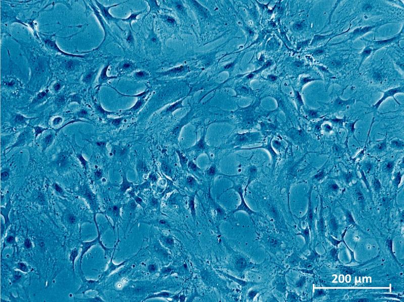 Microscope image of healthy cartilage cells.