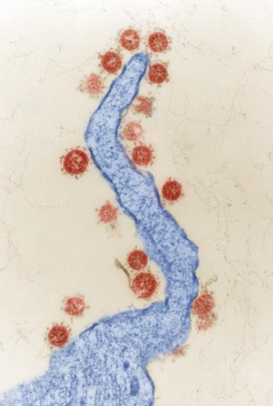 SARS-Coronavirus (Coronaviren). SARS in Vero-Zellen. Transmissions-Elektronenmikroskopie, Ultradünnschnitt.