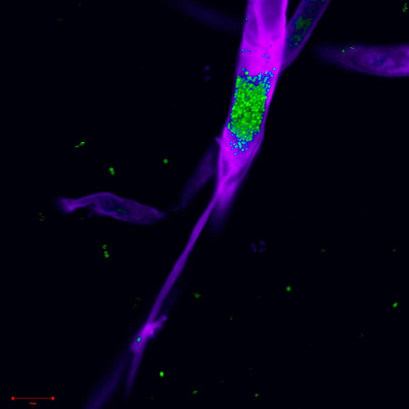 Mikroskopische Visualisierung der Bakterien im Pilz