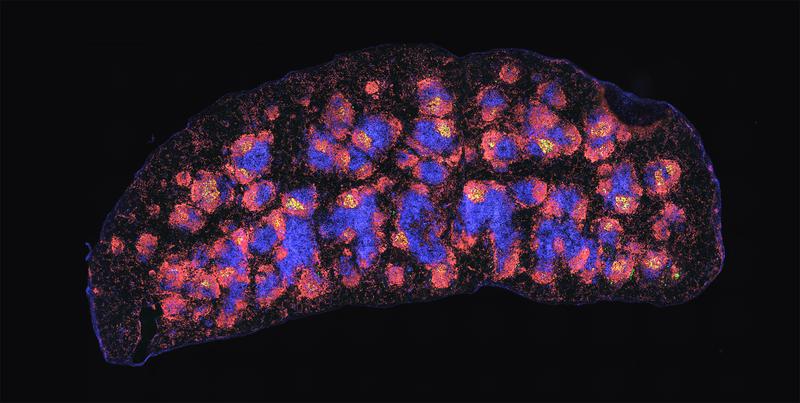 Milz einer Maus mit fluoreszierenden Antikörpern. In den gelben Arealen befinden sich die TFH-Zellen, die an der Aufrechterhaltung des immunologischen Gedächtnisses beteiligt sind.