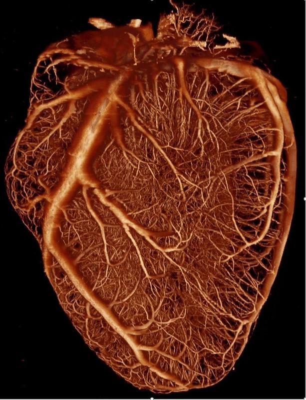 Dreidimensionale Rekonstruktion der Blutgefäße im Herzmuskel