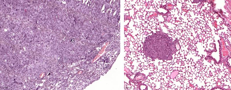 A lung tumor that expresses USP28 (left). On the right, however, tumors are shown in which USP28 has been "cut out" using the gene editing tool CRISPR/Cas9 – they are significantly smaller.