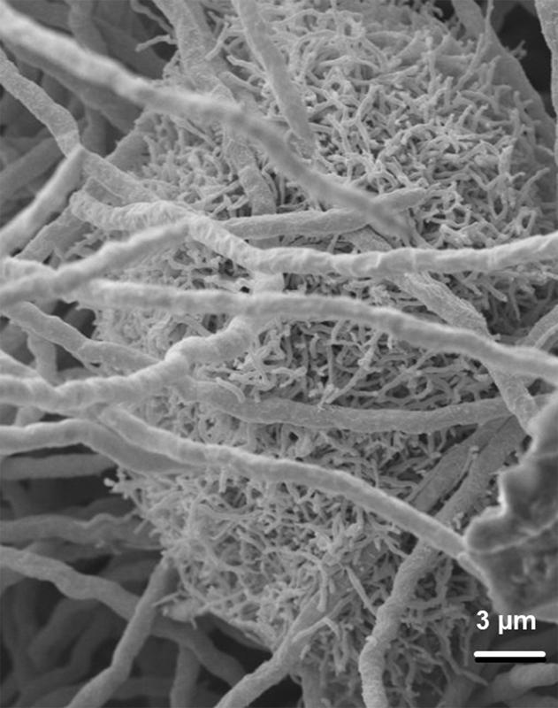 Gemeinsame Kultur des Pilzes Aspergillus fumigatus und des Bakteriums Streptomyces rapamycinicus in einer elektronenmikroskopischen Aufnahme.