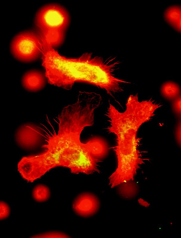 Immune cells by fluorescence microscopy: Blood stem cells remember a previous attack and produce more immune cells like these macrophages to fight a new infection