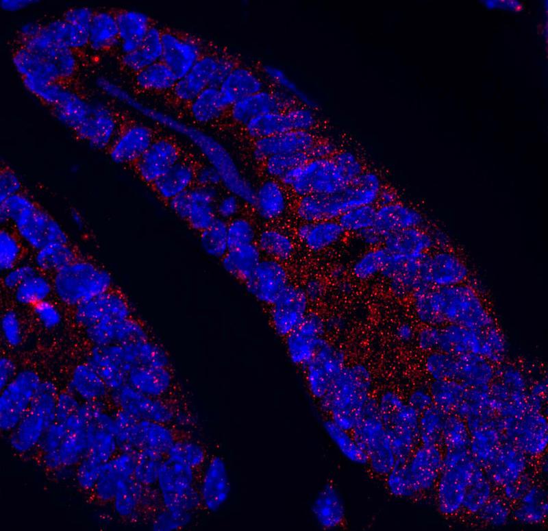 The protein MCL1 (red dots) within the small intestine of a healthy mouse. The nuclei of individual cells (blue) are also visible.