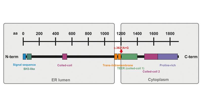 Struktur des TANGO1-Proteins mit einem lumenalen und zytoplasmatischen Teil. Die Punktmutation ist zwischen intramembrane und TEER-Domäne lokalisiert und trunkiert den zytoplasmatischen Teil.