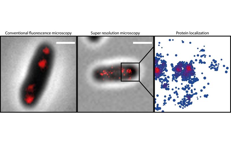  Das rot markierte Protein ParB in einer Bakterienzelle (l.); mit Hilfe von höchstauflösender Mikroskopie werden ParB-Einzelstrukturen sichtbar; die molekulare Architektur von ParB (r.).