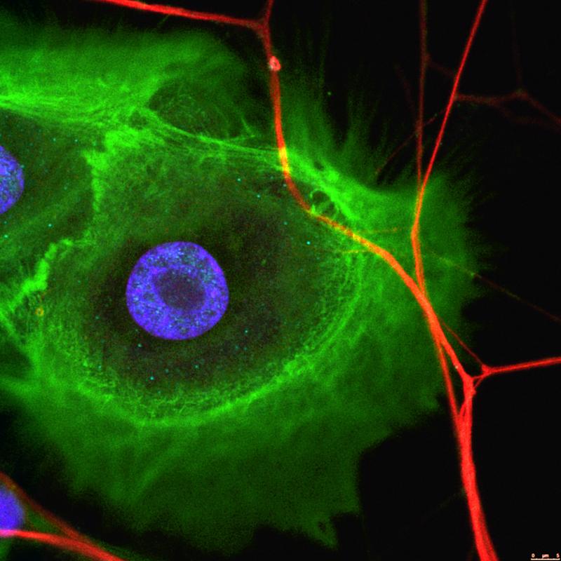 Krebszellen (grün) werden mit Nervenzellen (rot) innerviert. Sichtbar sind auch die Zellkerne (blau).