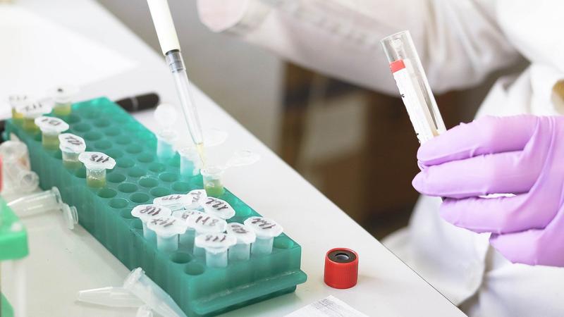 Entwicklung eines serologischen Tests zur Untersuchung von Blut- und Plasmaproben, um herauszufinden, ob eine Grundimmunität gegenüber SARS-CoV-2 vorliegt. 