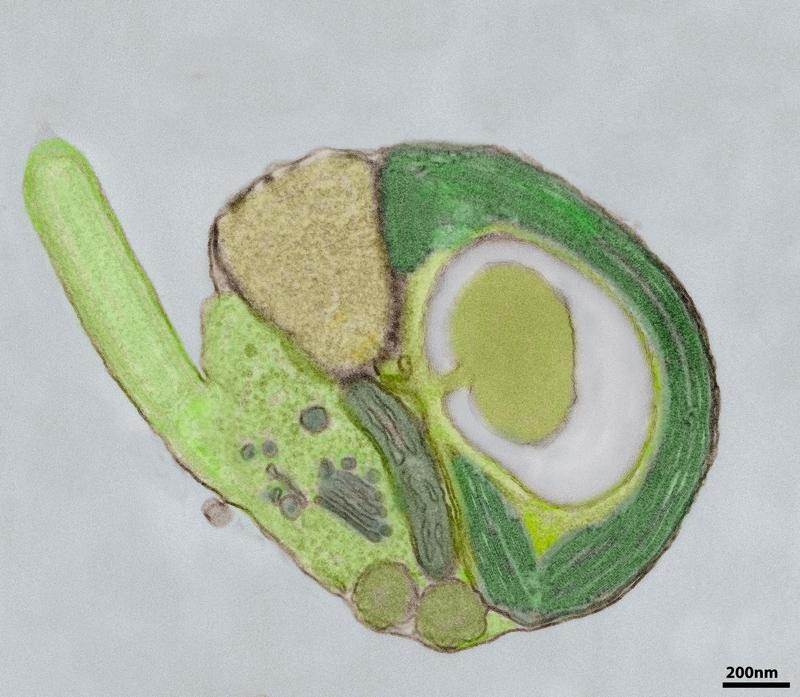 Eine Alge der Gattung Micromonas, für die erstmals Transformations-Protokolle vorgestellt werden. Da die Alge mit dem Chloroplast (hier in Grün) Photosynthese betreibt und sehr häufig im Ozean vorko