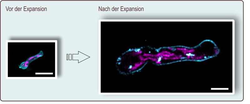 Bei der Expansionsmikroskopie wird das Präparat um mehr als das Vierfache vergrößert. Hier ist ein Keimschlauch von Aspergillus fumigatus vor und nach der Expansion zu sehen; Maßstab = 10 Mikrometer