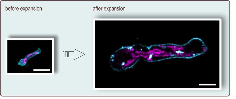 In expansion microscopy, the preparation is magnified more than four times. Here, a germ tube of Aspergillus fumigatus is shown before and after expansion; the scale corresponds to ten micrometers.