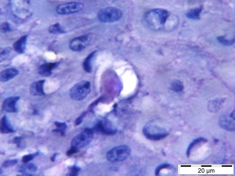 Der Parasit Entamoeba gingivalis dringt ins Zahnfleischgewebe ein und ernährt sich dort von Wirtszellen.