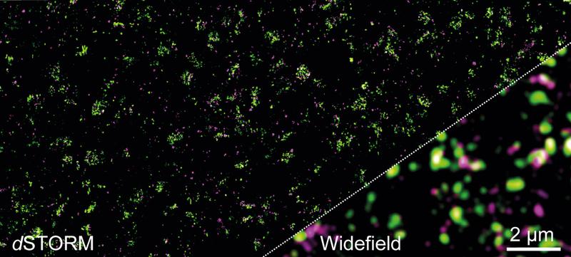 Der Glutamat-Rezeptor mGluR4 und andere Proteine in der präsynaptischen Membran. Links ein hochaufgelöstes Bild. Rechts konventionelle Fluoreszenzmikroskopie – molekulare Details sind nicht erkennbar