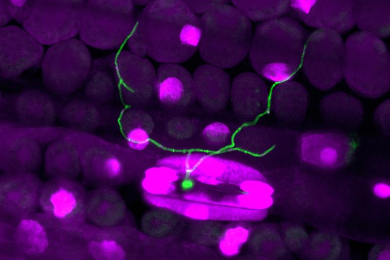 Fluorescent microscopy picture showing fungal hyphae growing through a wheat stoma in the early phase of infection. 